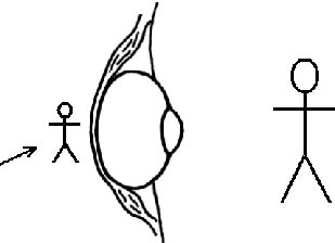 visión ojo hipermetropía