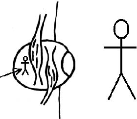 visión ojo miopía