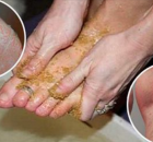 remedio-para-las-varices-y-callos